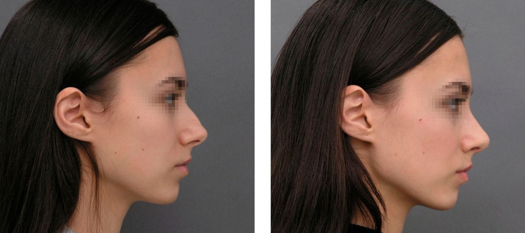 Что форма носа говорит о вашей личности: проверьте, не ошибаются ли физиогномисты