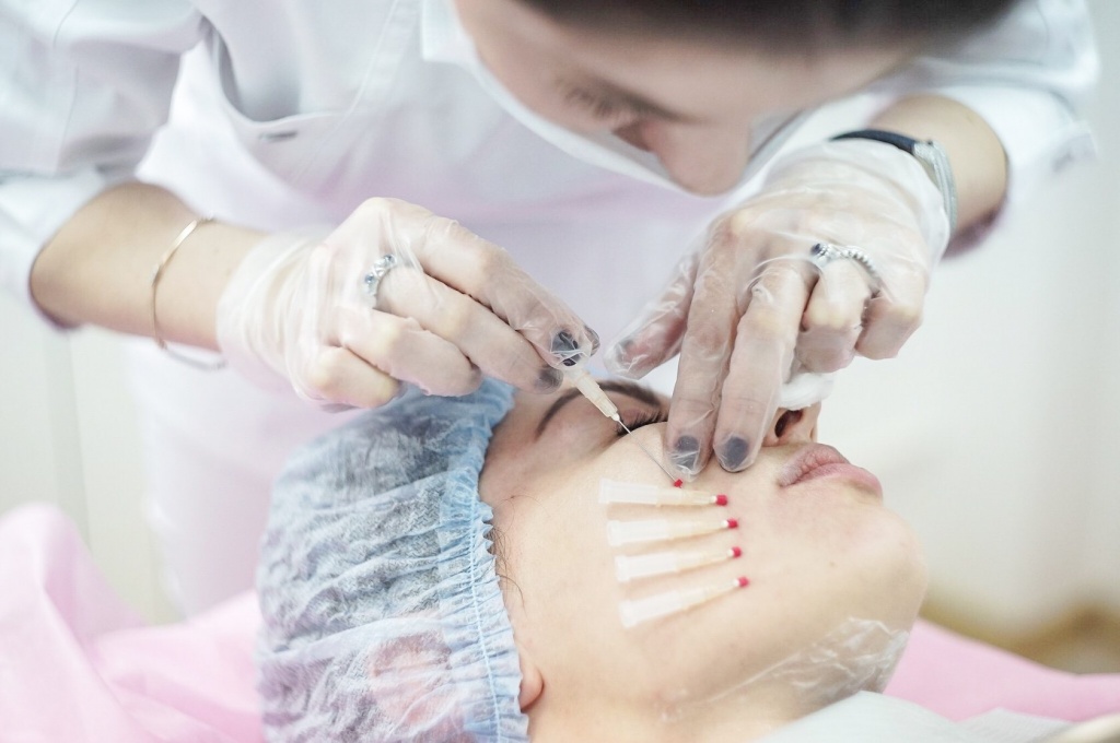 Нитевая подтяжка Нитевая подтяжка